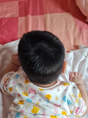 ลูก หัวเบี้ยวหน่อยๆ ทำไงดี