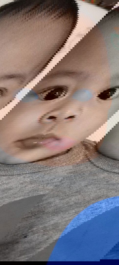 Bibir bawah bayi 5 bulan membiru