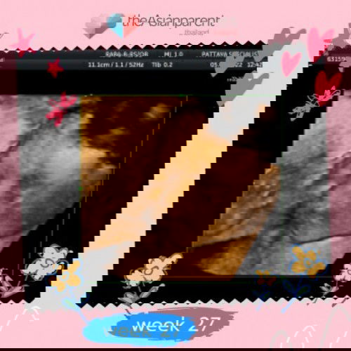 อัลตราซาวนด์ 4 มิติ แอบส่องเบบี้