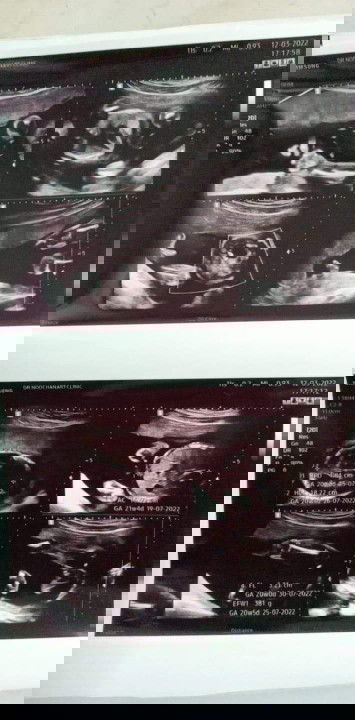 รูปไหนคือจิ้มมิน้องคะ