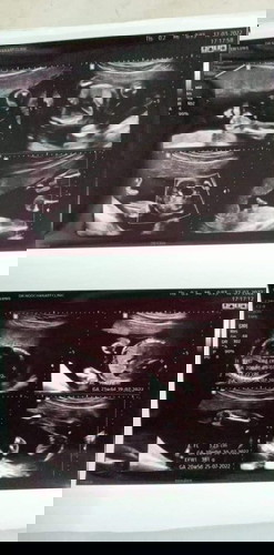 รูปไหนคือจิ้มมิน้องคะ