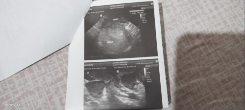 4 weeks pregnant