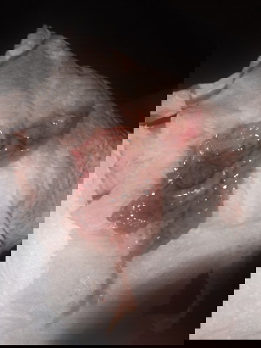 หลังคลอดมีเนื้อหลุด