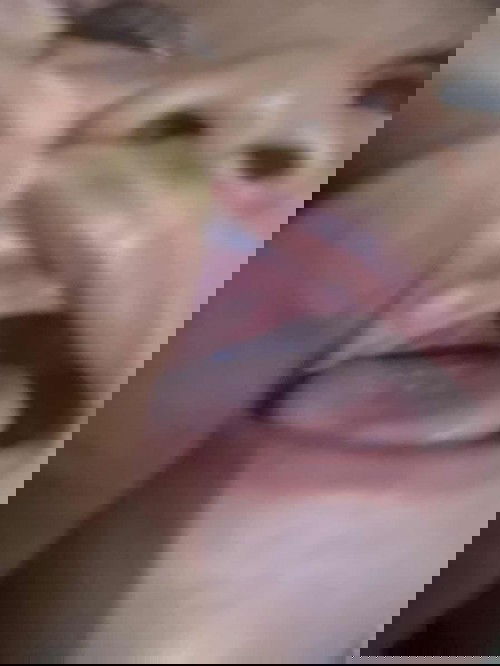 Apakah ini mau tumbuh gigi