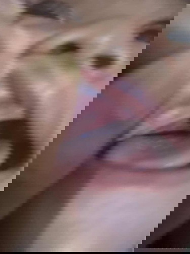 Apakah ini mau tumbuh gigi