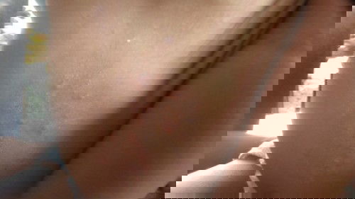 Bentol Bentol Merah besar kayak ruam? Ini kenapa? Dan obatnya apa iya?