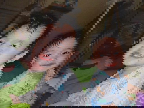 usia lahir 1 tahun belum tumbuh gigi