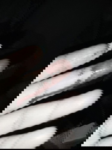 มีเลือดออกทางช่องคลอด