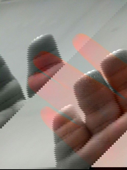 Telapak tangan kering