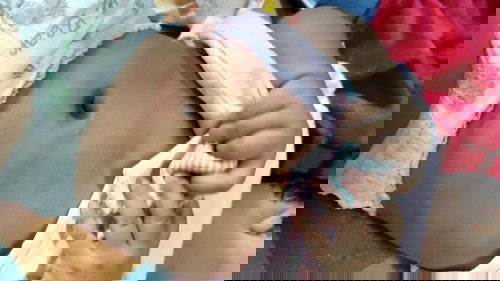 แบบนี้น้องแพ้นมไหมค่ะ