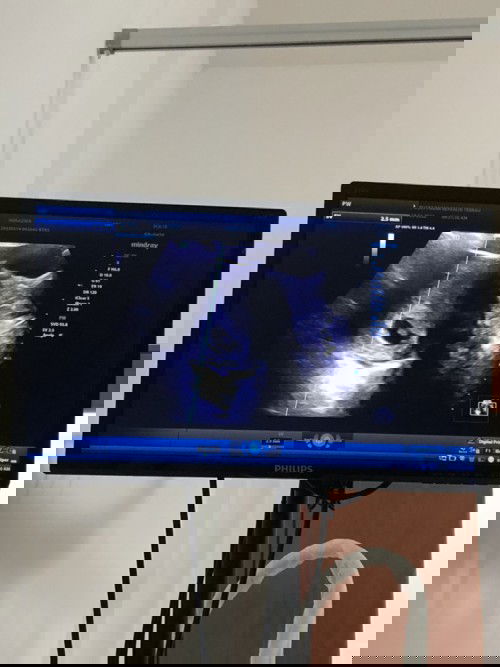 4/10/21 pernah keguguran..