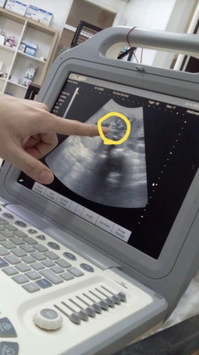 ผู้หญิงหรือผู้ชาย