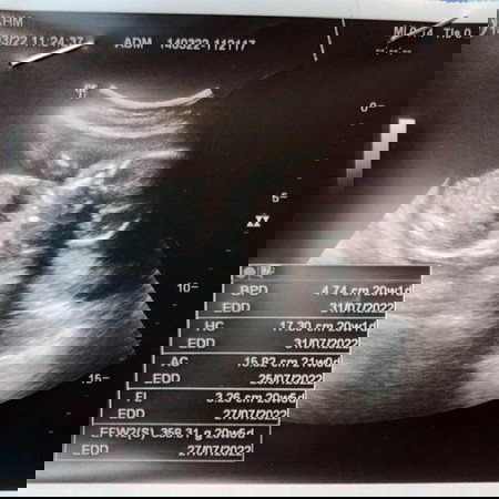 อยากทราบว่าน้องเพศไหนคะ