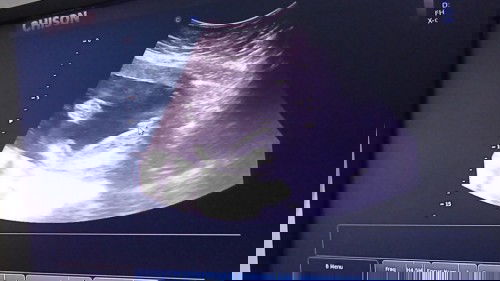 Seneng Akhirnya dapat Cewek