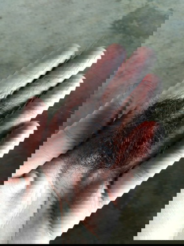 มีใครเป็นเหมือนกันบ้าง😓