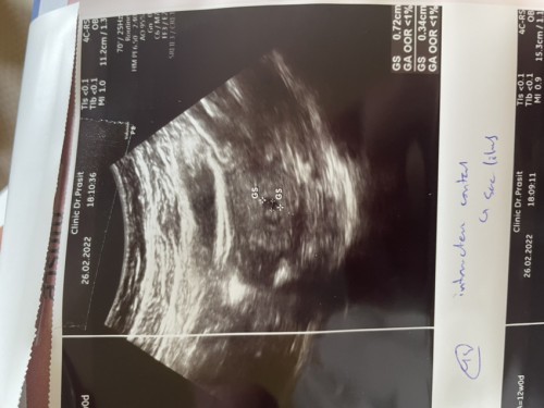 การซาวไม่เจอตัวน้อง