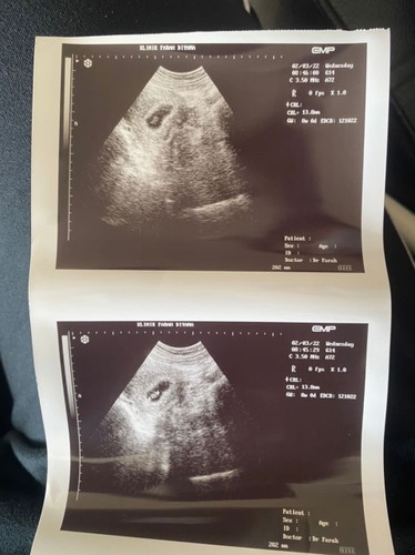 Baby 8 weeks