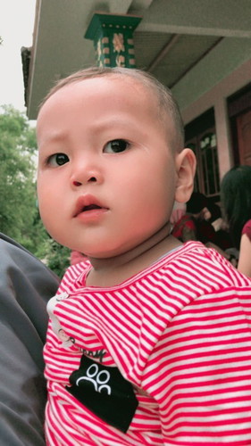 Anak saya umur 1 thn