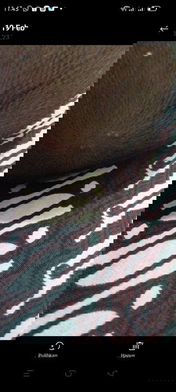 Kepala bayi ada kaya bentol tapi ada nanah nya