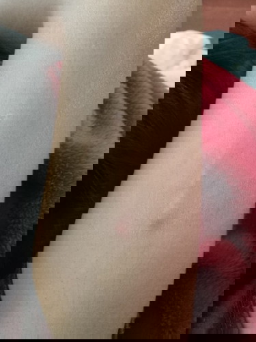 ฝังยาคุมกำเนิดแล้วมีอาการแบบนี้ผิดปรกติไหมคะ