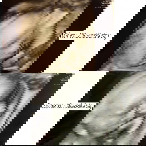 ตอนนี้ท้องที่2 ยังตื่นเต้นอยู่ค่ะ🥰