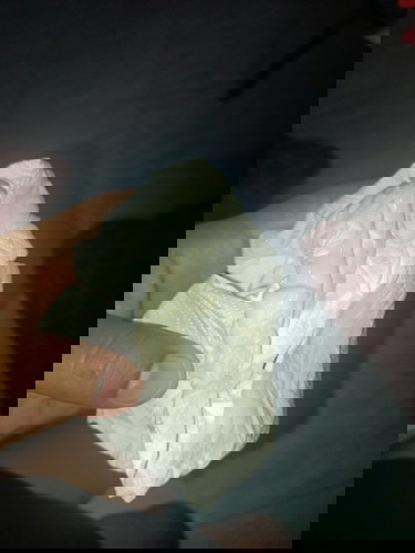 ตั้งครรภ์33วีค3วัน