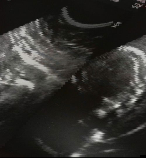 เป็นเพราะสาเหตุอะไรแม่ๆทราบไหมคะ