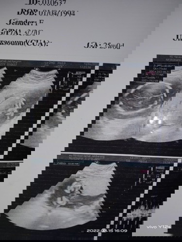 Gender F artinya apa