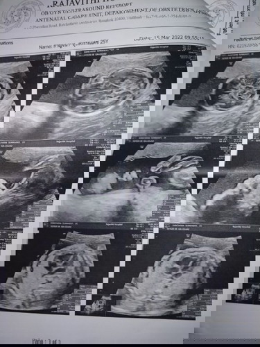 ซาวด์มาแล้วแต่ยังใม่เห็นเพศคะ