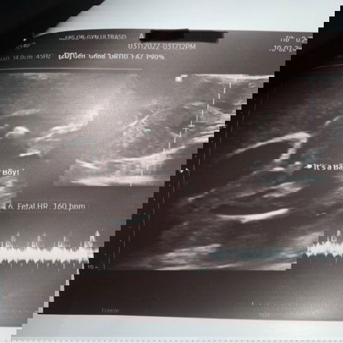 Sure na po ba ito na baby boy? Bibili na kasi ng mga gamit niya 😊😌