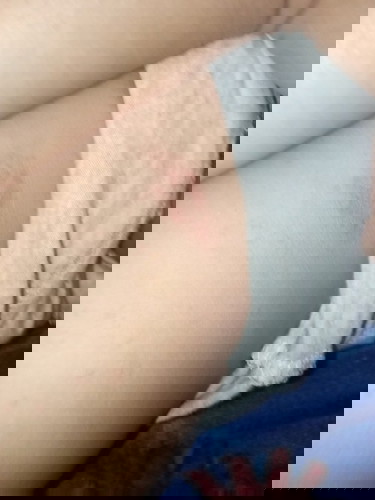Skin rash?