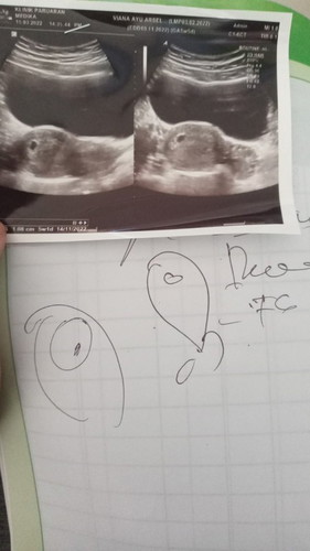 Usg 5w5d ada flek warna kuning-kecokelatan