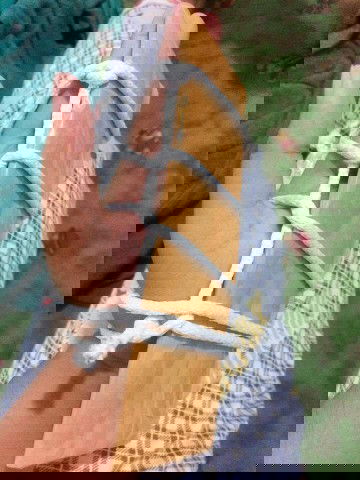 Sobrang sakit na daliri