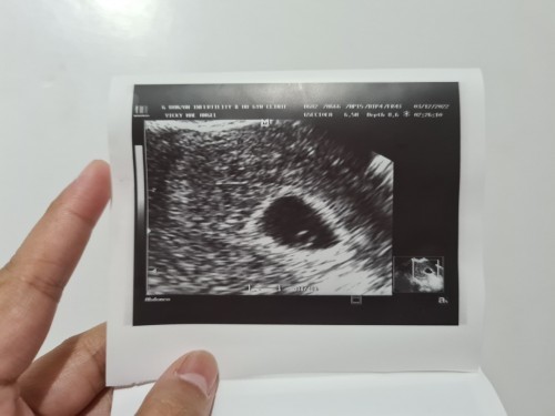 Pregnancy Question