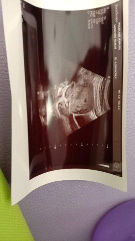 Berapa minggu kalau mcm ni?