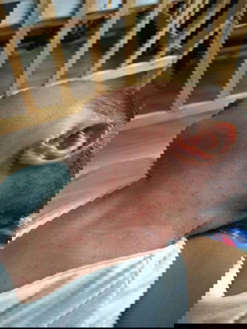 Normal lang po ba ito sa baby ko?