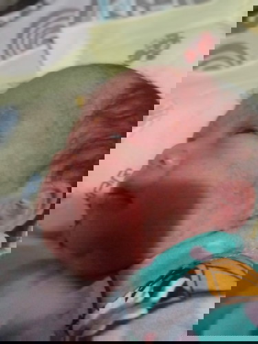 20 days old baby baby skin problem