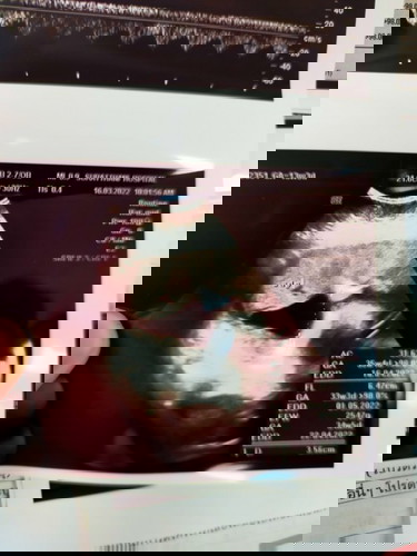 แม่ๆคะ  33+1  น้ำหนัก2547 มากไปไหมคะ