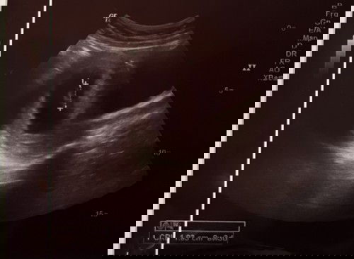 Butuh pendapatnya bun 🙏🏻