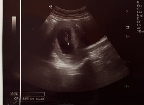 Butuh pendapatnya bun 🙏🏻