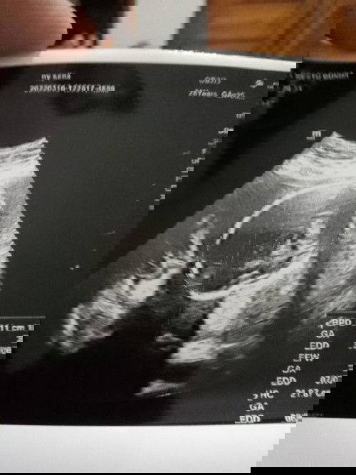 Hari ini sya pergi kontrol kandungn