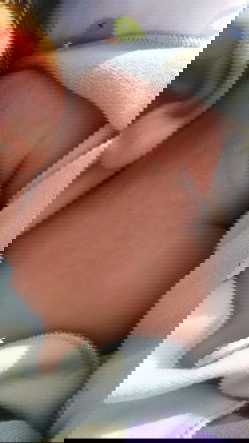 Tanya tentang bruntusan