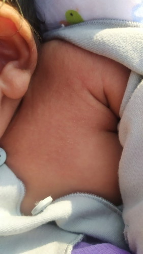 Tanya tentang bruntusan