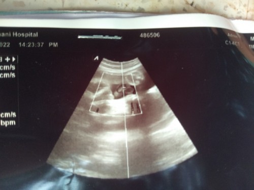 ได้ลูกชายค่าา❤️