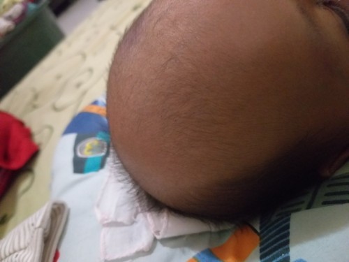 Rambut bayi NB