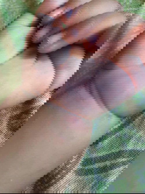 Salep atau obat gatal