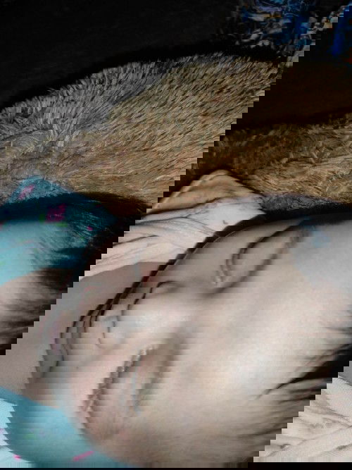 Bercak merah di bagian kelopak mata