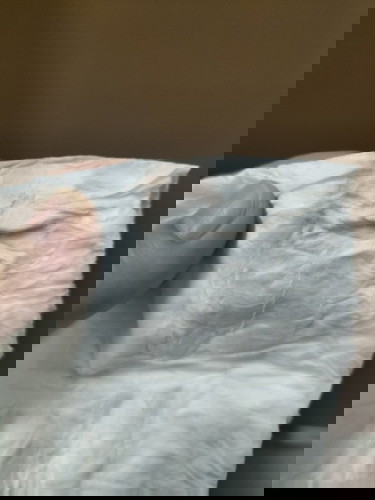 มีเลือดออก