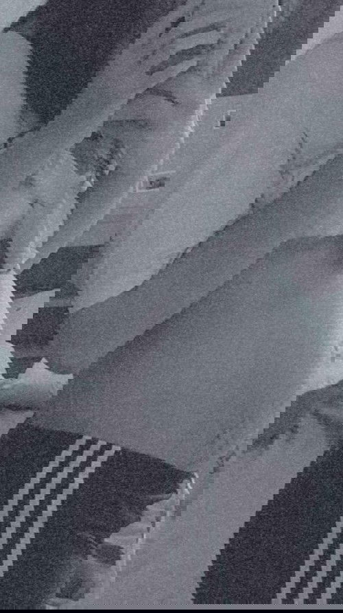 ท้องลด 37+2