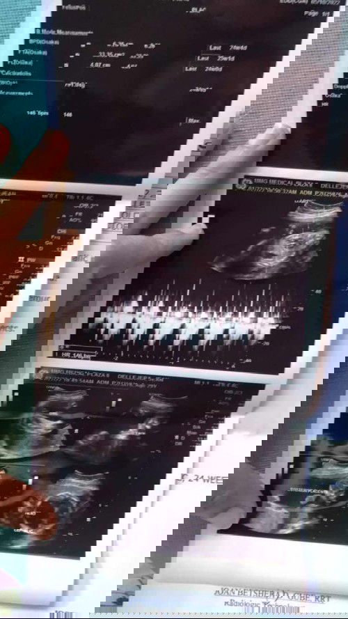 32weeks ang 6days❤️😍